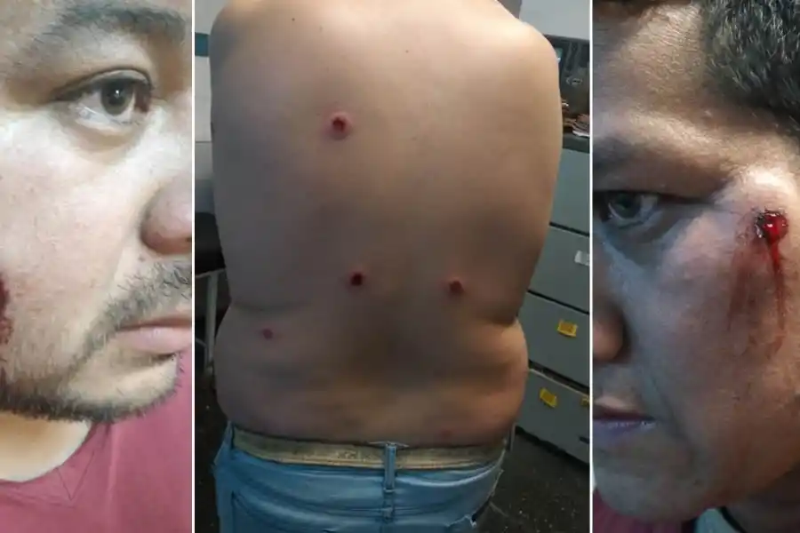 El Gobierno dio su versión sobre la represión a obreros azucareros durante el paro de transportistas