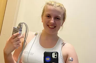 El extraño caso de una joven que es alérgica a las emociones fuertes