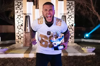 Alex Caniggia se operó la mandíbula: ¡mirá cómo quedó!