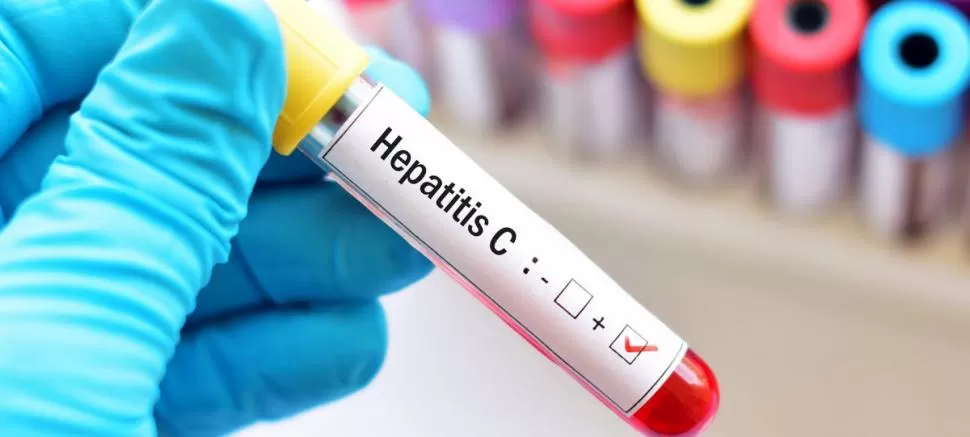 HEPATITIS C. Se estima que afecta a cerca del 1% de la población de Argentina y evoluciona a formas crónicas en el 80% o 90% de los casos.  