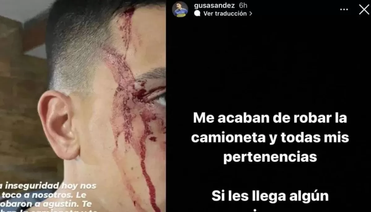 SÁNDEZ SUFRIÓ UN VIOLENTO ASALTO. Imagen de Instagram