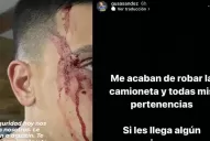 Un futbolista de Boca sufrió un terrible asalto: quedó ensangrentado por los golpes