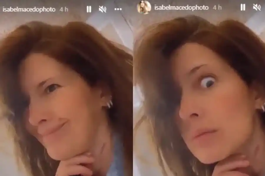 Isabel Macedo mostró cómo quedó su cuello después de un accidente doméstico
