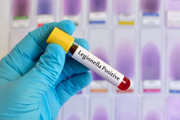 FR propone la creación del Programa de Concientización y Prevención de la bacteria Legionella