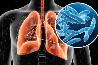 Legionella en Tucumán: tras la confirmación de los casos por Vizzotti, ¿de qué se trata esta enfermedad?