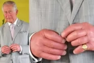 “Dedos de salchicha”: Cuál es el particular problema que afecta al rey Carlos III