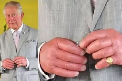 “Dedos de salchicha”: Cuál es el particular problema que afecta al rey Carlos III