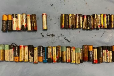 Se comió 50 pilas y tuvieron que extraérselas mediante una cirugía