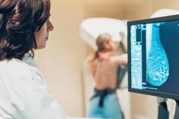 Cáncer de mama: se aprobó una terapia que ayuda a evitar recaídas