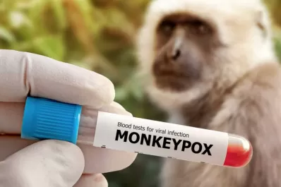 Viruela del mono en Tucumán: dónde se originó la enfermedad y cuándo fue el primer brote