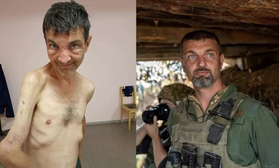 El antes y después del soldado ucraniano Mykhailo Dianov 