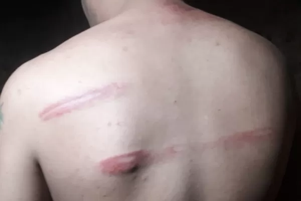 Denuncian que policías hacen pelear a presos en una comisaría