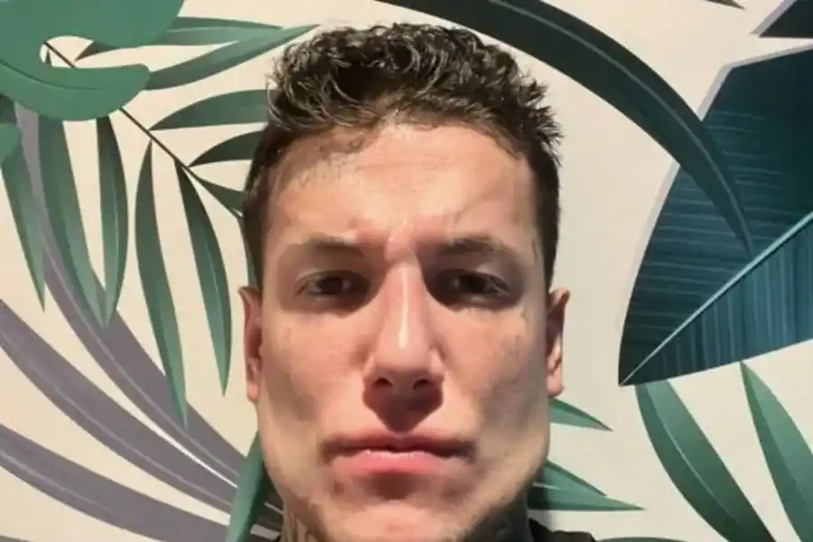 SE OPERÓ LA MANDÍBULA. Así quedó Alex Caniggia.