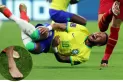 La impresionante imagen del tobillo de Neymar tras su lesión