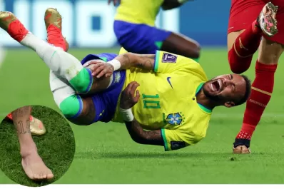 La impresionante imagen del tobillo de Neymar tras su lesión
