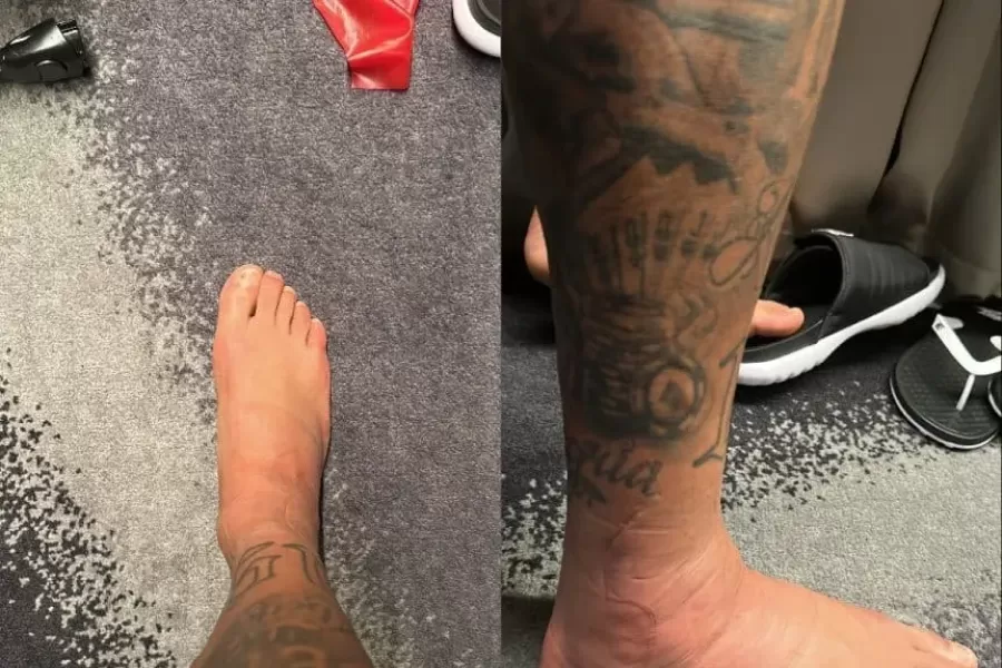 La impresionante imagen del tobillo de Neymar tras su lesión