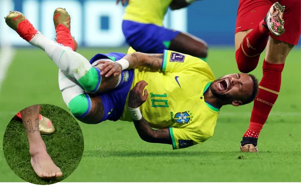 La impresionante imagen del tobillo de Neymar tras su lesión