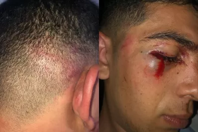 Denuncian a cuatro jóvenes por un violento ataque en un club