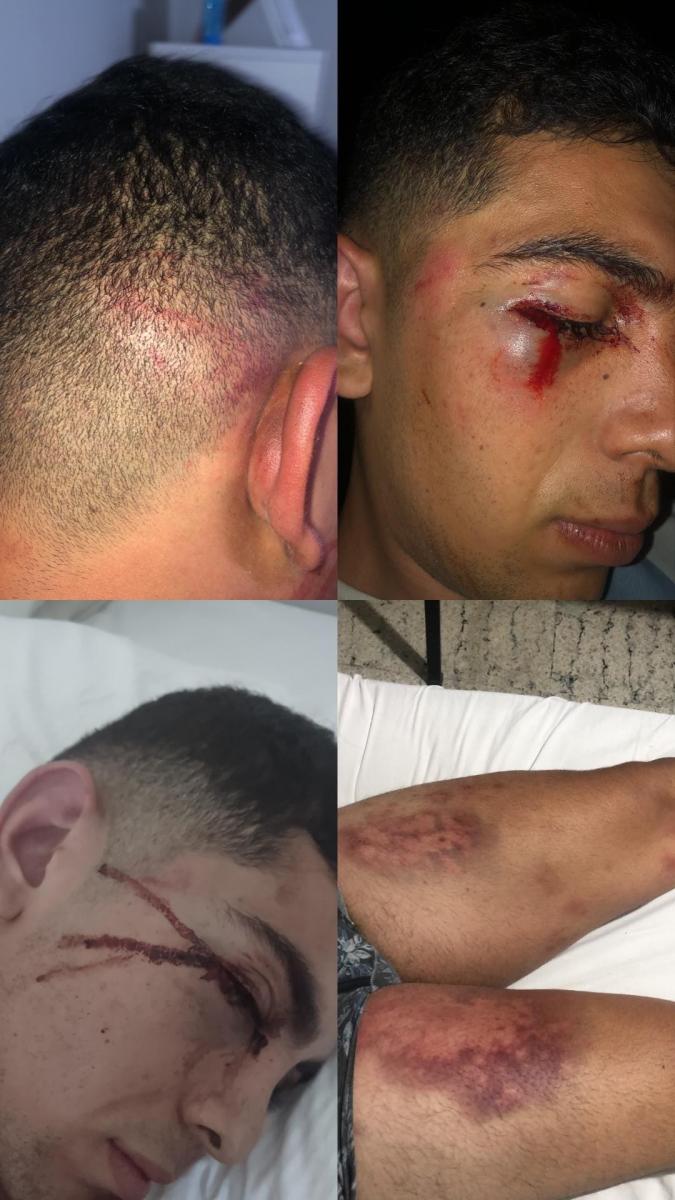 Denuncian que un joven fue agredido por una patota durante los festejos por la Copa del Mundo