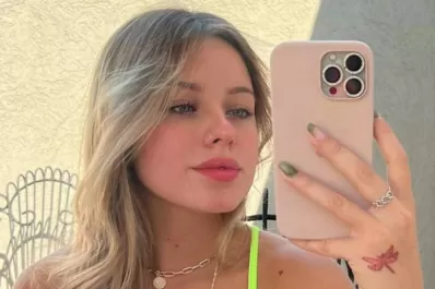 Coti de Gran Hermano se hizo un retoque estético y lo mostró en sus redes