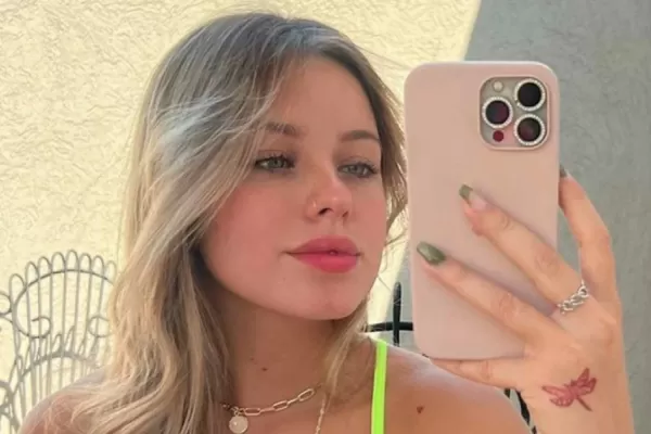 Coti de Gran Hermano se hizo un retoque estético y lo mostró en sus redes