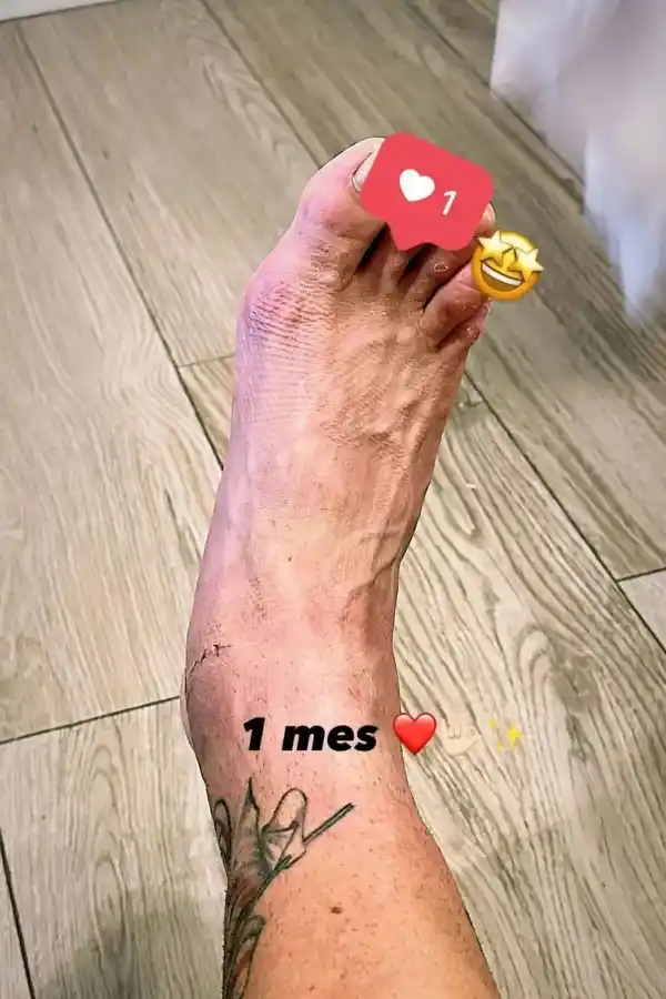 Así está el tobillo del tucumano Matías Kranevitter, a un mes de su lesión