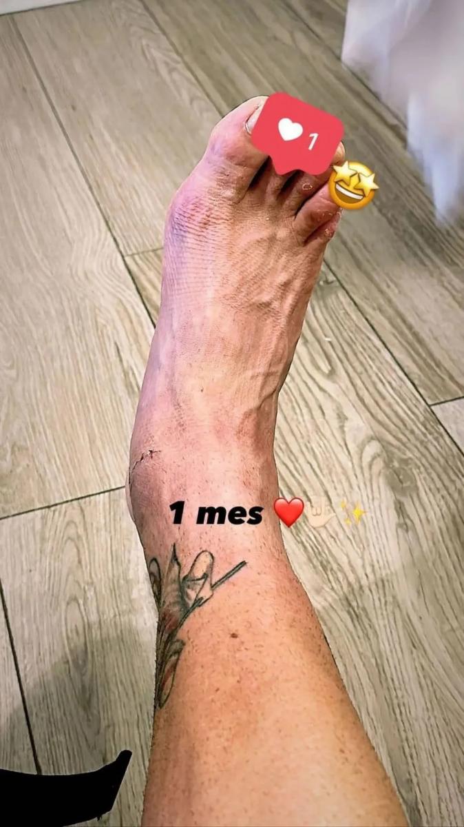 Así está el tobillo del tucumano Matías Kranevitter, a un mes de su lesión