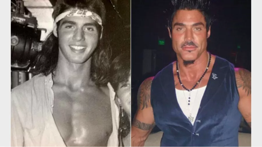 Ricardo Fort antes de todas sus cirugías (Foto: Twitter)