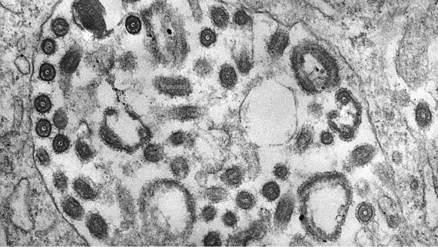 La enfermedad tiene un periodo de incubación de 2 a 21 días, según la OMS (Photo by Smith Collection/Gado/Getty Images).