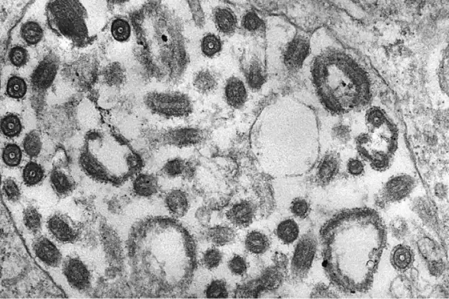 La enfermedad tiene un periodo de incubación de 2 a 21 días, según la OMS (Photo by Smith Collection/Gado/Getty Images).