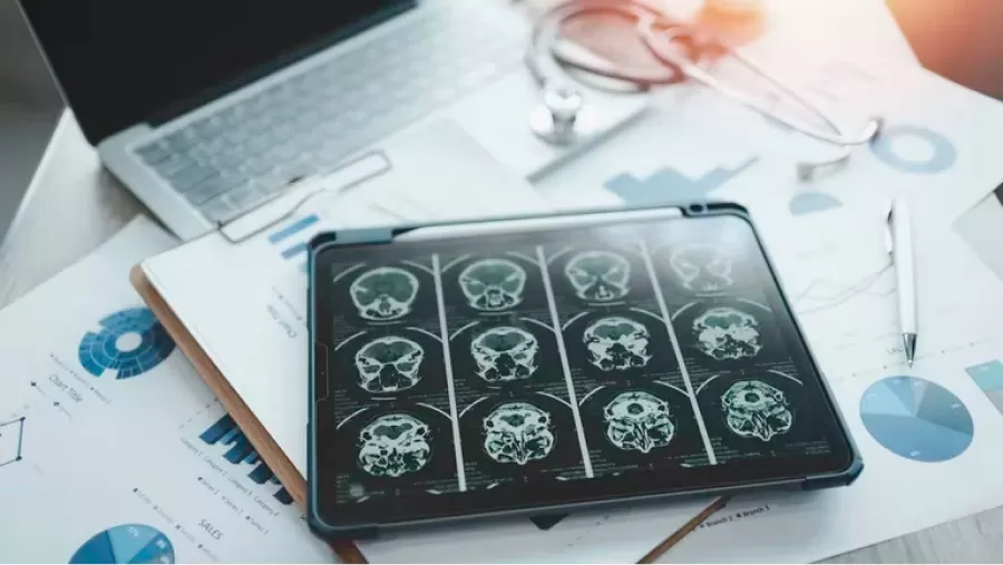 En el mundo están aumentando los casos de Alzheimer de inicio precoz (antes de los 65 años). Pero el caso del joven en China sería infrecuente/ (Getty)