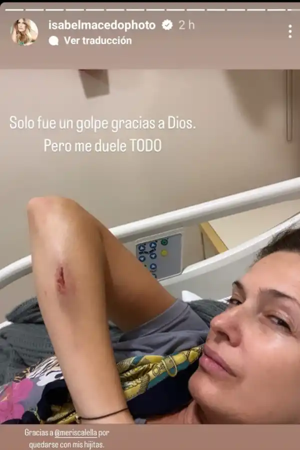 Isabel Macedo sufrió un accidente y terminó internada de urgencia