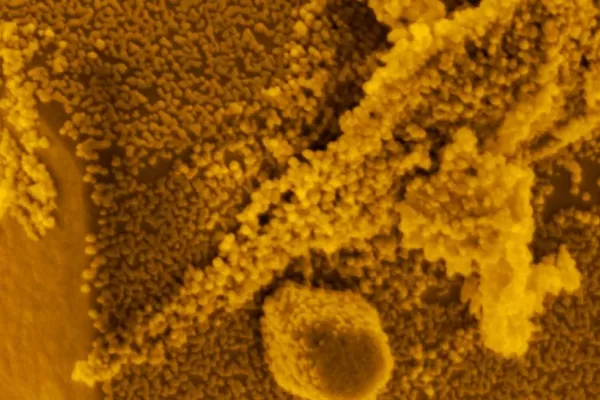 Las nanoestructuras que permiten rescatar el ambiente