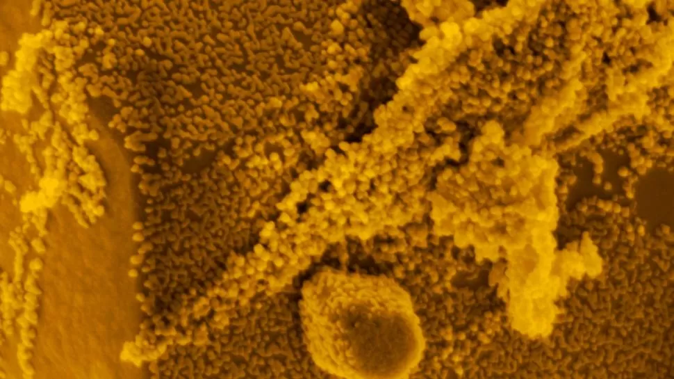BAJO EL MICROSCOPIO. Imagen del proceso de degradación del colorante. 