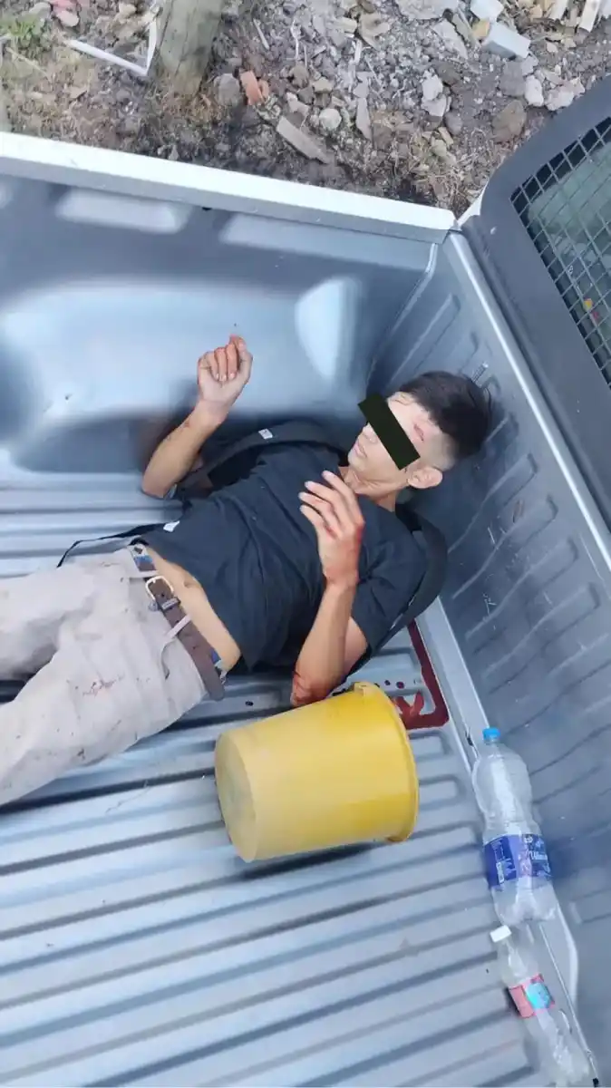 Video: dos motochorros escapaban a toda velocidad y chocaron contra un patrullero de la Policía