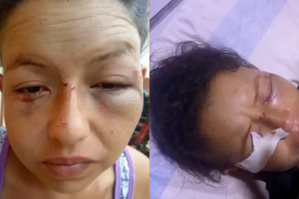 Acusó a una vecina de coquetear con su marido y la atacó a cuchillazos