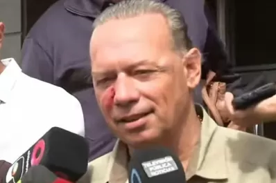 Berni habló luego del feroz ataque que sufrió: Uno muere de pie y no arrodillado