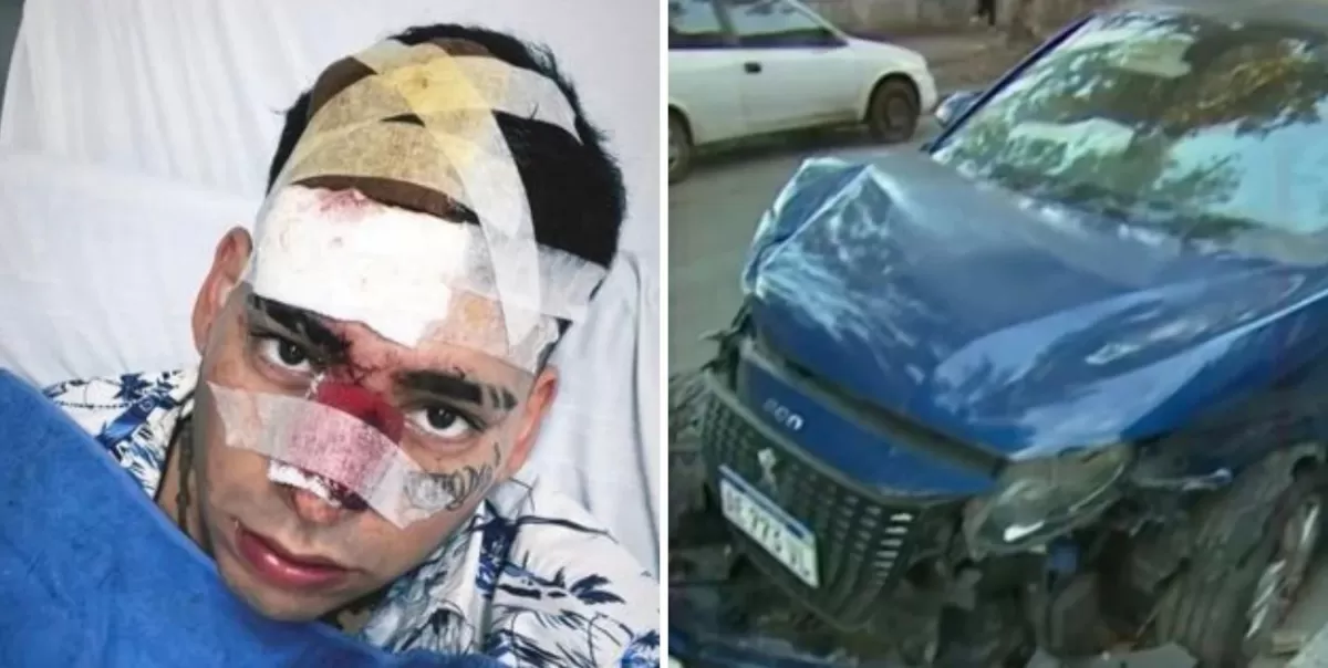 El cantante Kaleb Di Masi tuvo un gravísimo accidente automovilístico: “Estoy vivo de milagro”