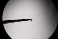 Dengue: cuáles son los síntomas de la nueva cepa que tiene en vilo al país