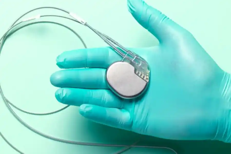 La colocación de marcapasos es un procedimiento que demora pocos minutos.