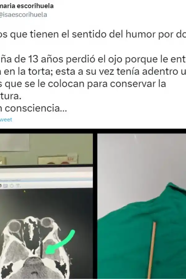De la broma a la tragedia: una mujer casi pierde uno de sus ojos por el tradicional “tortazo” en su fiesta de cumpleaños