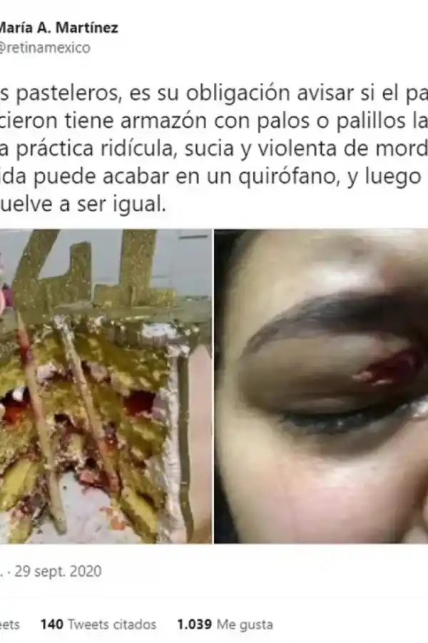 De la broma a la tragedia: una mujer casi pierde uno de sus ojos por el tradicional “tortazo” en su fiesta de cumpleaños
