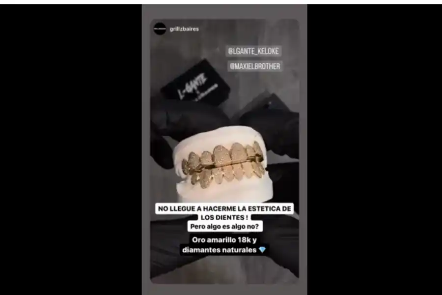 Con oro y diamantes: así es la nueva dentadura millonaria de L-Gante