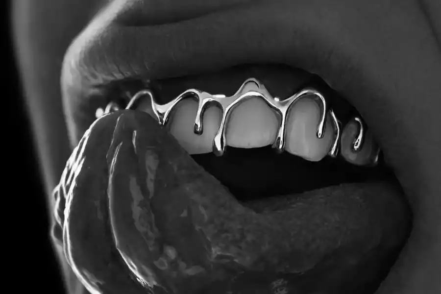 Con oro y diamantes: así es la nueva dentadura millonaria de L-Gante