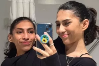 Una de las siamesas influencer está de novia y contó cuál es el acuerdo que hizo con su hermana: “Cuando me duermo, él habla con ella”