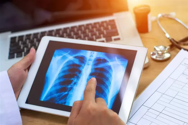 Cáncer de pulmón: expertos de la OMS crearon un algoritmo que predice casos