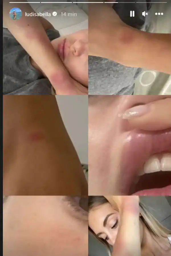 Ludmila mostró imágenes de las presuntas agresiones que sufrió por parte de Lautaro Acosta.}