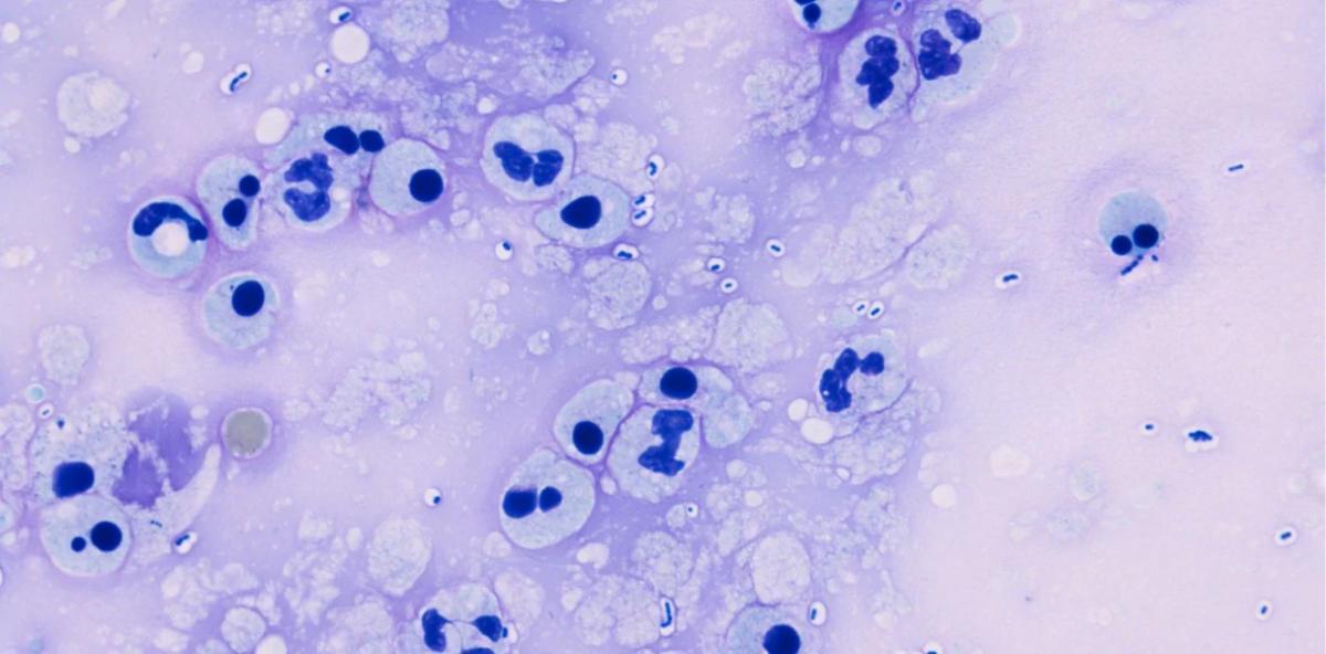 Imagen de microscopio del neumococo que constituye una de las causas de meningitis. (Foto: Creative Commons/William R. Geddie)