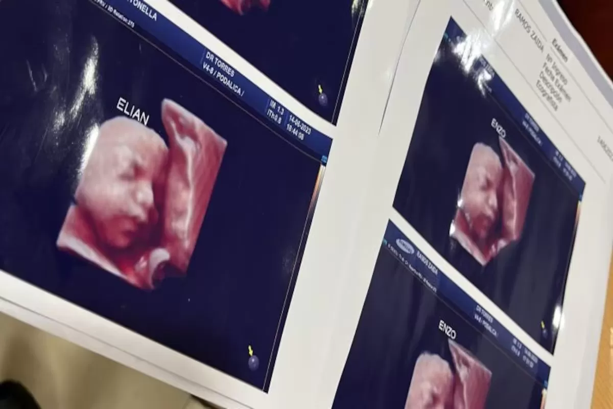 Estafa a madres: denuncian que una clínica utilizaba la misma ecografía para todas las embarazadas