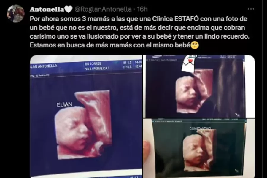 Estafa a madres: denuncian que una clínica utilizaba la misma ecografía para todas las embarazadas